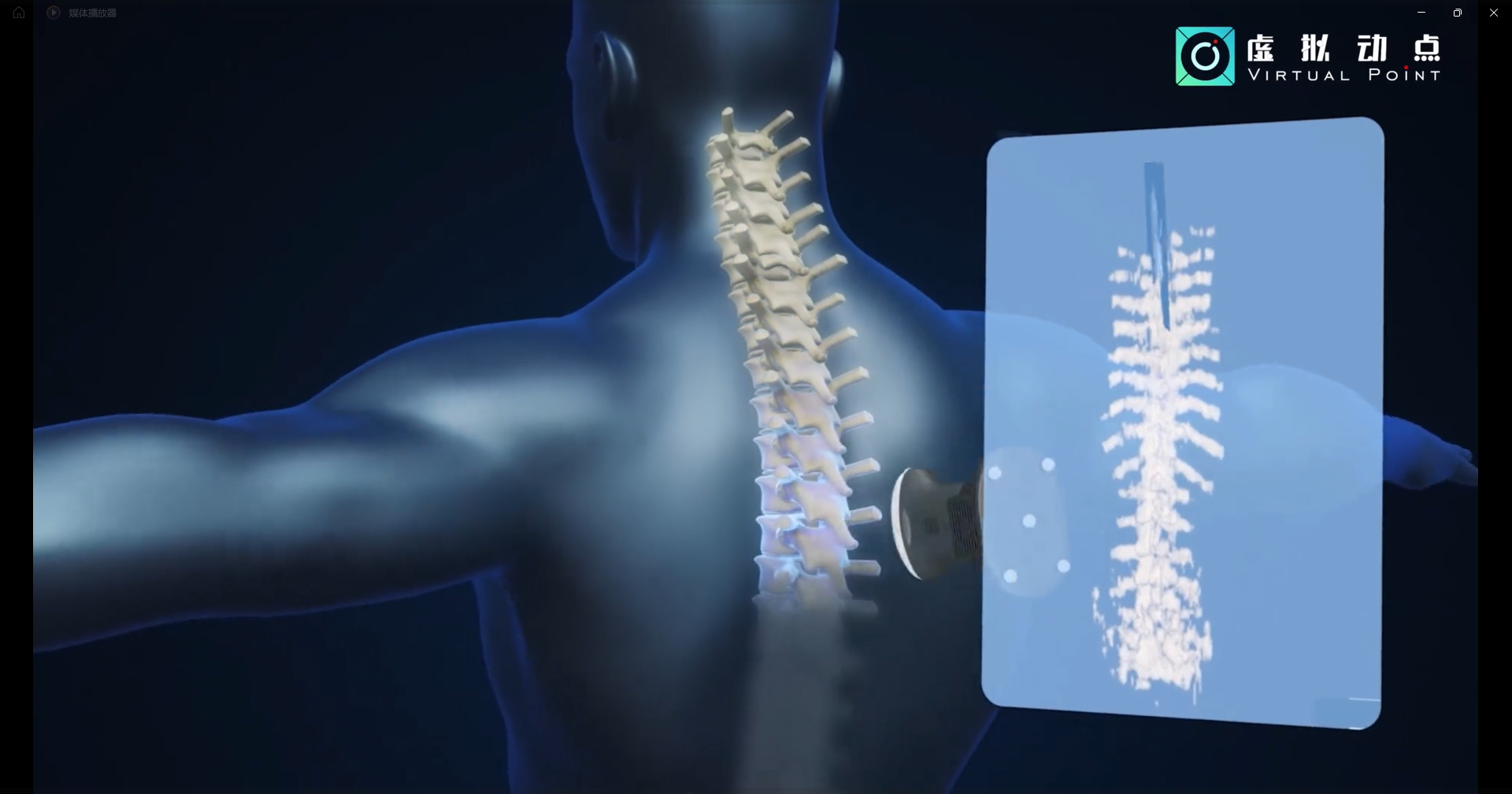 FUN88·乐天(中国游)·虚拟动点OptiTrack开创3D超声成像在脊柱诊断中的应用